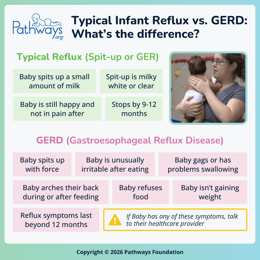 Pathways.org infographic titled, “Typical Infant Reflux vs. GERD: What’s the difference?”. Symptoms of typical reflux and GERD are listed in boxes under the subheadings “Typical Reflux (Spit-up or GER)” and “GERD (Gastroesophageal Reflux Disease)”. Typical reflux symptoms include: Baby spits up a small amount of milk, spit-up is milky white or clear, Baby is still happy and not in pain after, stops by 9-12 months. GERD symptoms include: Baby spits up with force, Baby is unusually irritable after eating, Baby gags or has problems swallowing, Baby arches their back during or after feeding, Baby refuses food, Baby isn’t gaining weight, reflux symptoms last beyond 12 months. Below the GERD symptoms is a warning that reads “If Baby has any of these symptoms, talk to their healthcare provider”.